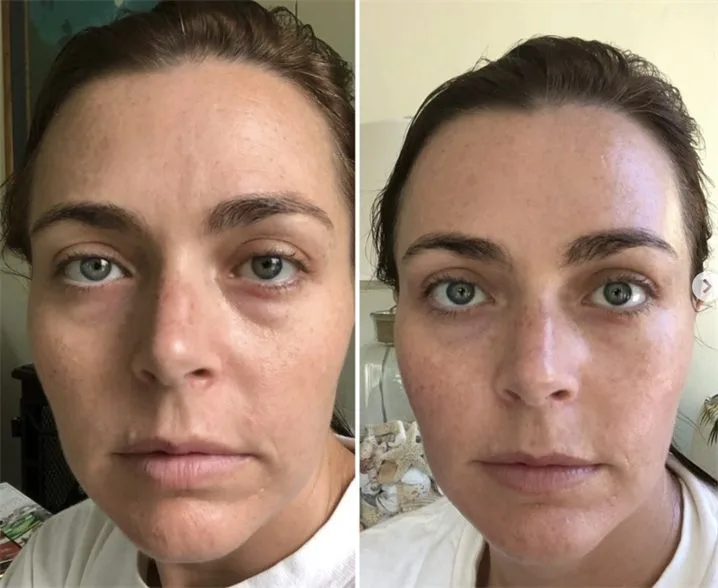 Amanda K. — before and after