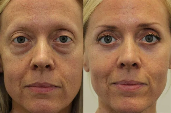 Rebecca T. — before and after